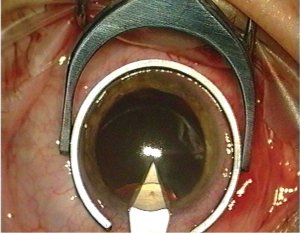 Eye of the Artist
